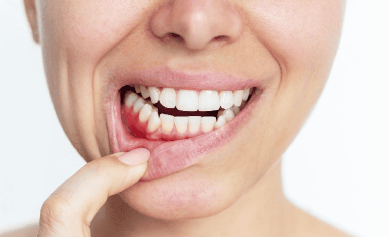 Periodontología en Coapa, CDMX: Cuida tus encías y dientes